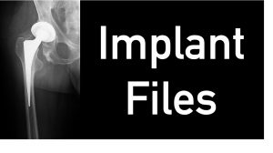 Implant Files