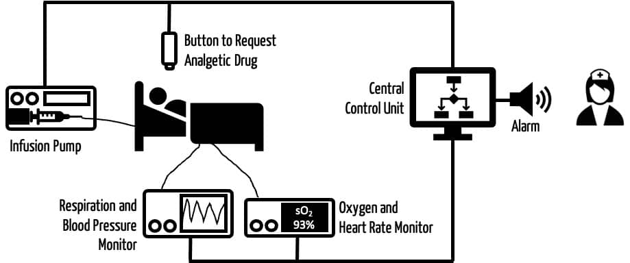 Schematische Zeichnung, die ein autonomes System für die Schmerzmittelbehandlung zeigt. Es besteht aus einem Patient, mehreren Monitoren, einer Infusionspumpe, einem Knopf, mit dem der Patient mehr Schmerzmittel "beantragen" kann sowie einer zentralen Steuereinheit, die auch Alarme auslösen kann.