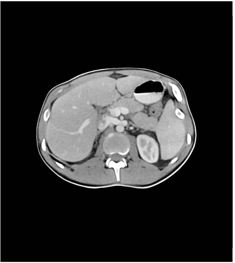 Phantome verhalten sich im CT wie (simulierte) Menschen und erlauben damit, CTs zu verifizieren und zu validieren, ohne "echte" Patienten einer Strahlenbelastung auszusetzen.